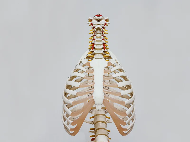 How Spinal X-Rays works at Chiropractic Fitness
